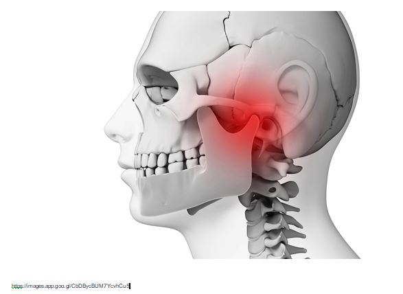 DTMSbaraini - Problemas crônicos na ATM costumam ser classificados como  Disfunção da Articulação Temporomandibular (DTM). Aqui, estão incluídos  sintomas como mandíbula estalando, dores de cabeça frequentes e até mesmo  dificuldades para abrir